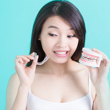 Everything You Should Know About Dental Lumineers: The Best Alternative to Dental Veneers