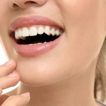 Dental Inlays and Onlays: Procedure, Types, and Risks