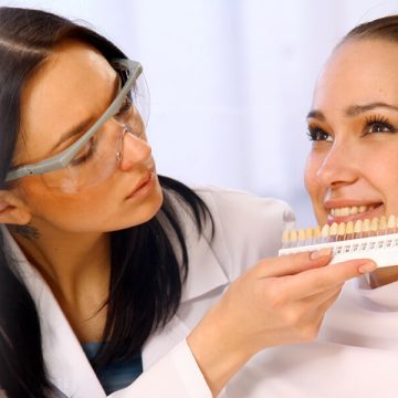 How Often Do Veneers Need to Be Replaced?